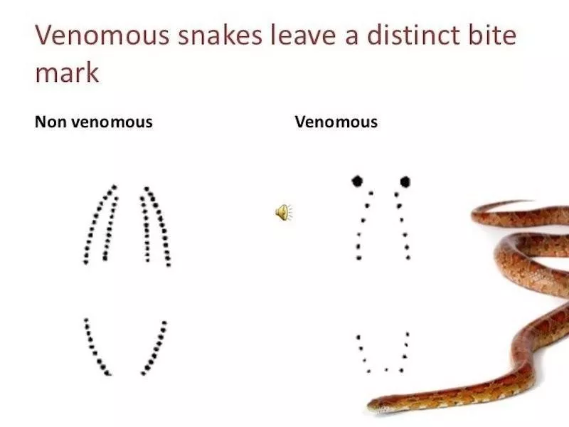 Snake bite